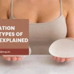 Breast Augmentation Surgery: Types of Implants Explained