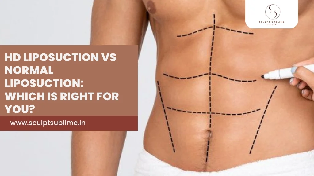 HD Liposuction vs Traditional Liposuction