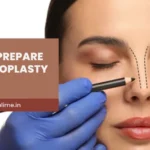 How to Prepare for Rhinoplasty Surgery: A Step-by-Step Guide