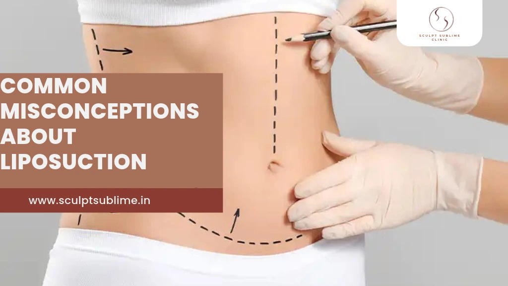 Liposuction Myths